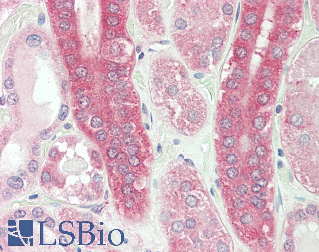 IHC-plus™ CAPN1 / Calpain 1 Antibody (aa468-481)