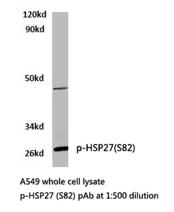 HSPB1 / HSP27 Antibody (phospho-Ser82)
