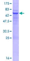 Human MICB Protein (Recombinant GST)