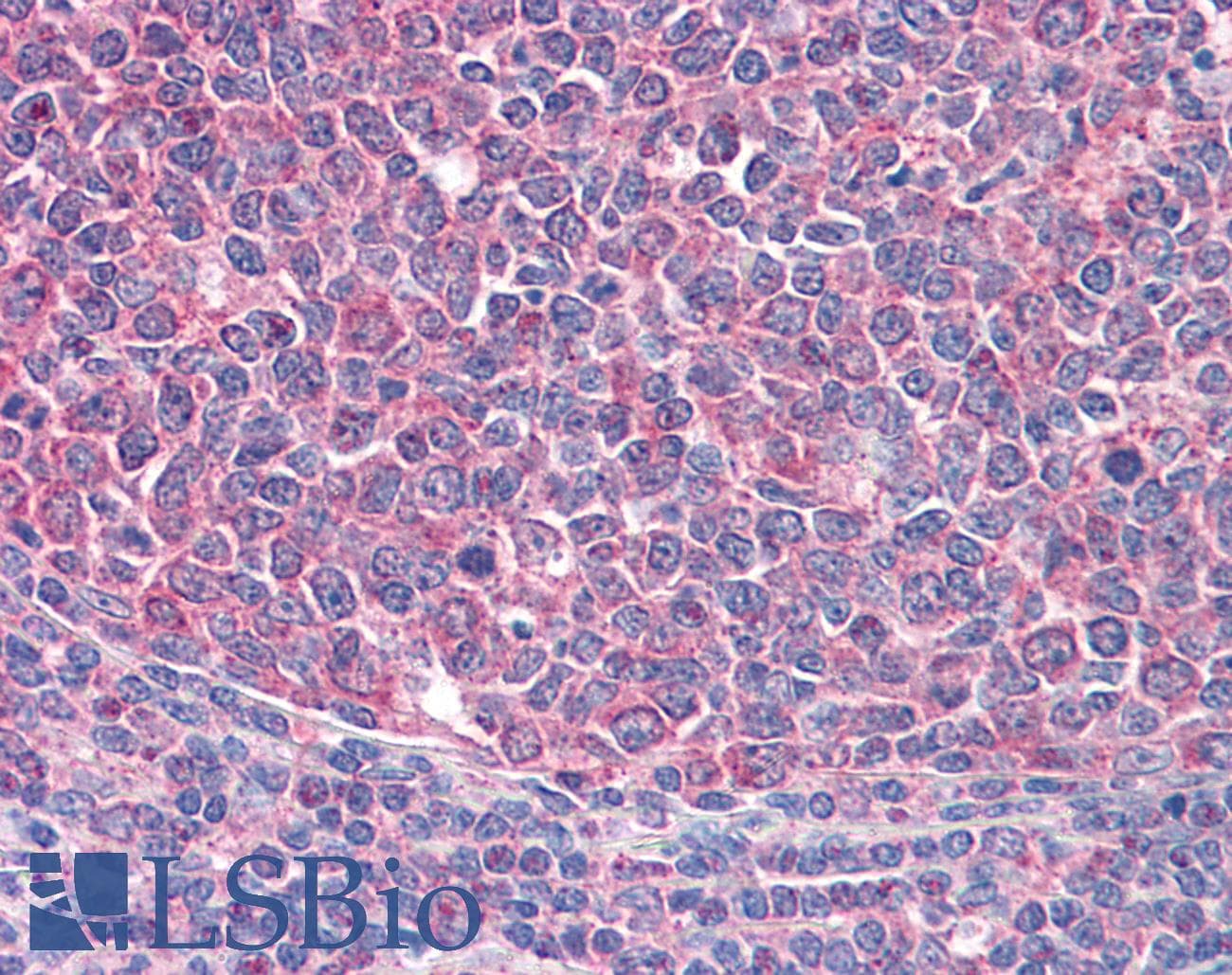 IHC-plus™ ICOS / CD278 Antibody (aa57-71)