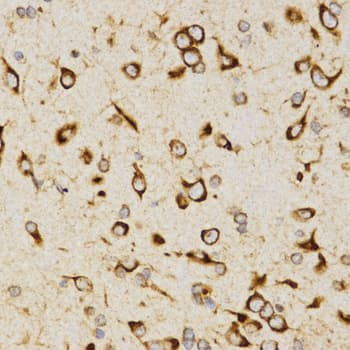 Polyclonal Rabbit anti-Human LAMP3 / CD208 Antibody (IHC, WB)