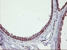 ERBB2 / HER2 Antibody (aa676-1255, clone OTI3F11, Carrier-free)