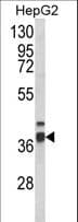 Polyclonal Rabbit anti-Human ECI2 / PECI Antibody (aa331-358, IHC, WB)