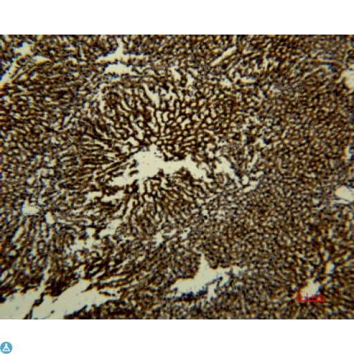 TF / Transferrin Antibody