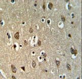 TSPAN20 / UPK1B Antibody (aa159-188)