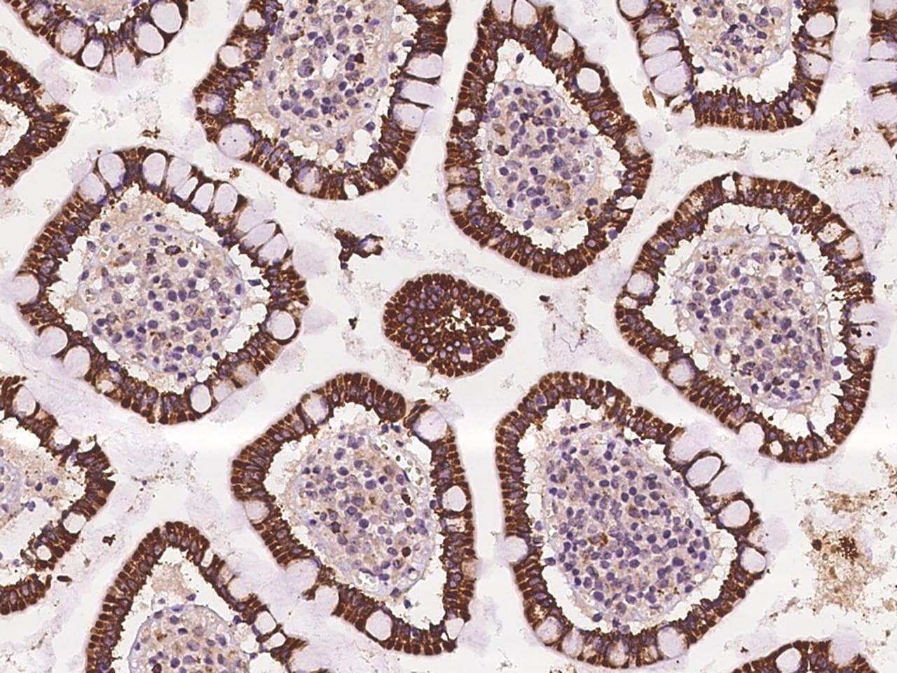 ADAM17 / TACE Antibody