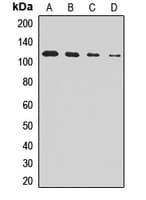 Polyclonal Rabbit anti-Human AGAP2 / PIKE Antibody (IHC, WB)