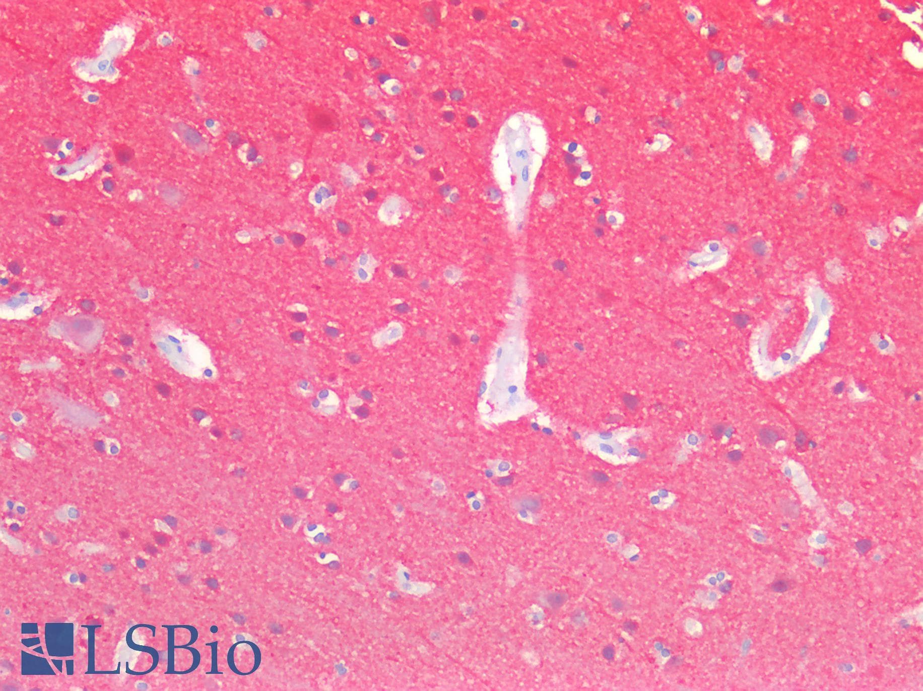 PathPlus™ Polyclonal Rabbit anti-Human ENO2 / NSE Antibody (IHC, WB)
