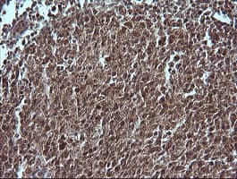 MAP2K1 / MKK1 / MEK1 Antibody (clone OTI2A1, Carrier-free)