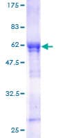 Human WDR6 Protein (Recombinant GST)