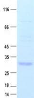 Human PLAC1 Protein (Recombinant Myc-DDK (Flag), C-terminus)