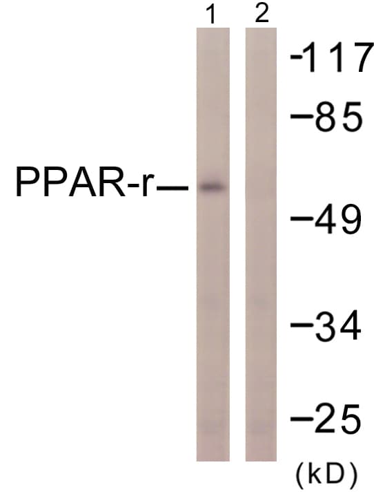 PPARG / PPAR Gamma Antibody (aa78-127)