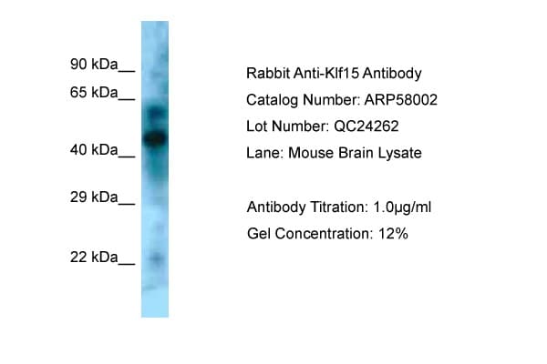 KLF15 Antibody (N-Terminus)