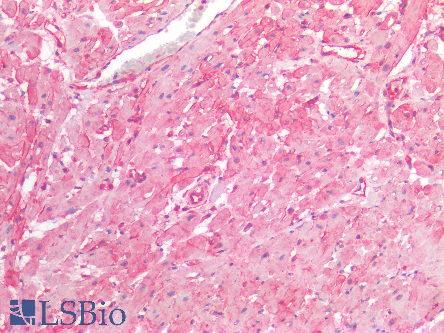 IHC-plus™ NTN1 / Netrin 1 Antibody