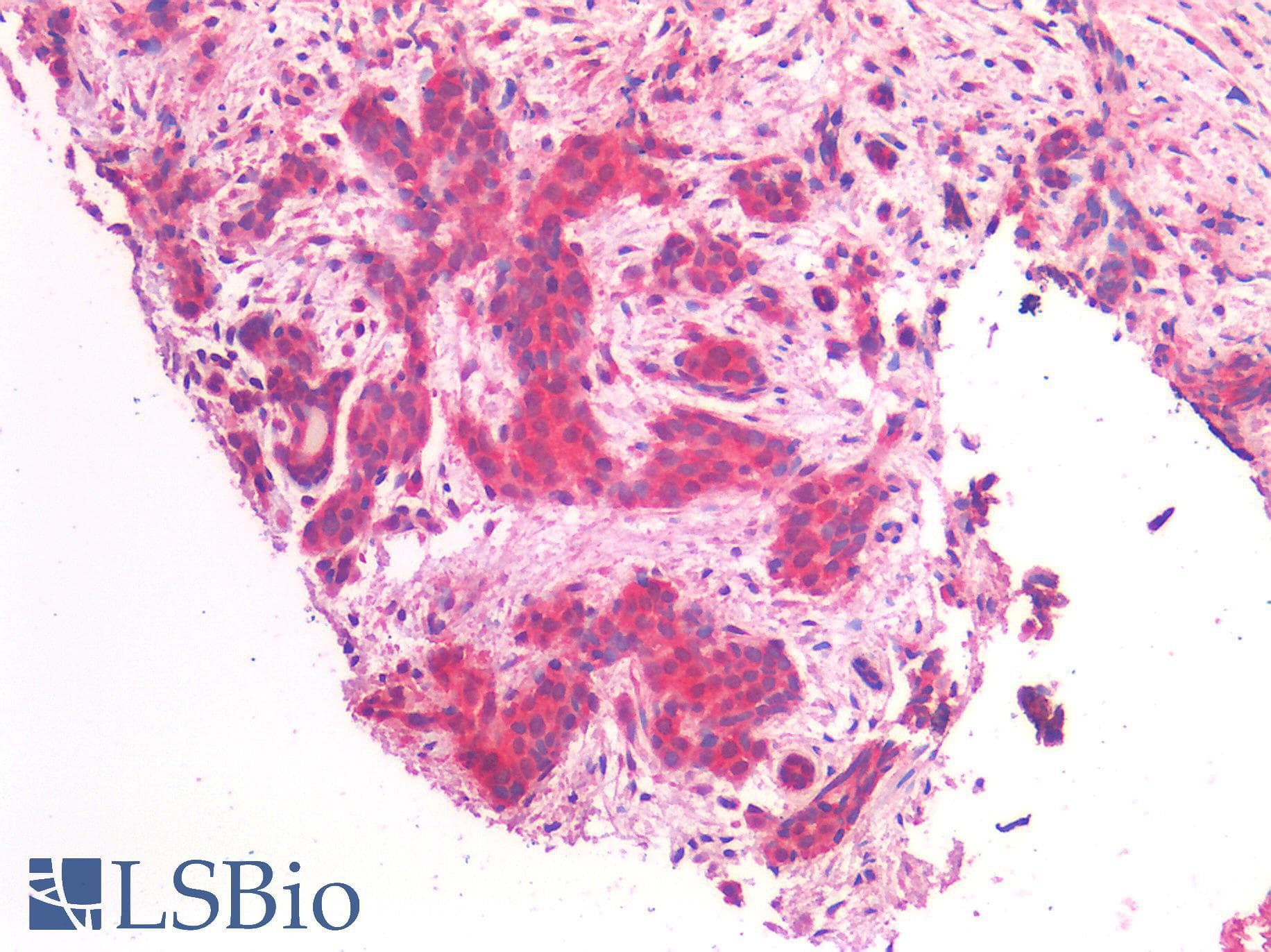 IHC-plus™ ERBB2 / HER2 Antibody