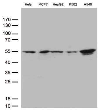 IKBKG / NEMO / IKK Gamma Antibody (clone OTI6B7)