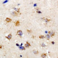 Polyclonal Rabbit anti-Human EIF2S3 / EIF2G Antibody (IHC, WB)