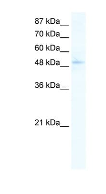 Polyclonal Rabbit anti-Human SIRT7 / Sirtuin 7 Antibody (aa317-366, IHC, WB)