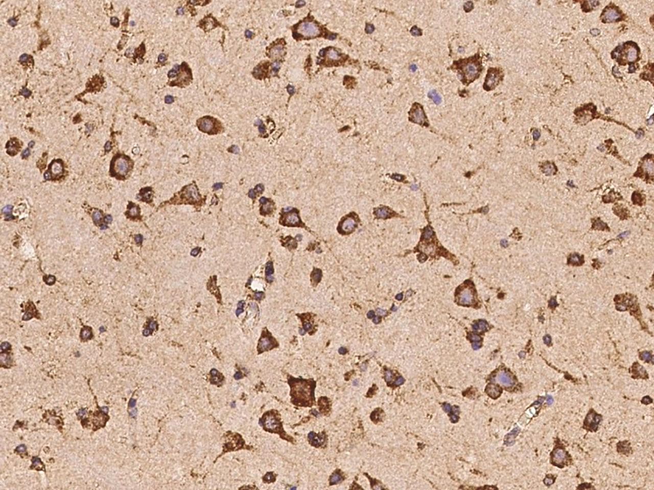 Polyclonal Rabbit anti-Human OARD1 / C6orf130 Antibody (IHC)