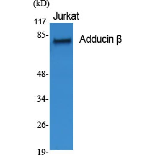 ADD2 Antibody (440-520 aa, Internal)