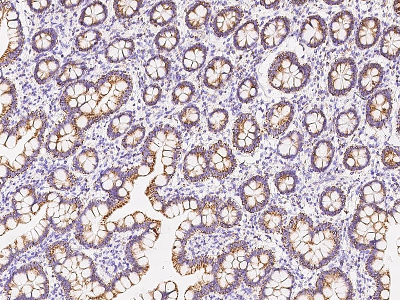 UQCRC1 Antibody (Preservative Free)