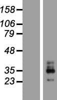 KCNMB3 Protein (Over-Expression Lysate Myc-DDK (Flag))