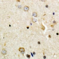Polyclonal Rabbit anti-Human TH / Tyrosine Hydroxylase Antibody (N-Terminus, IHC, WB)