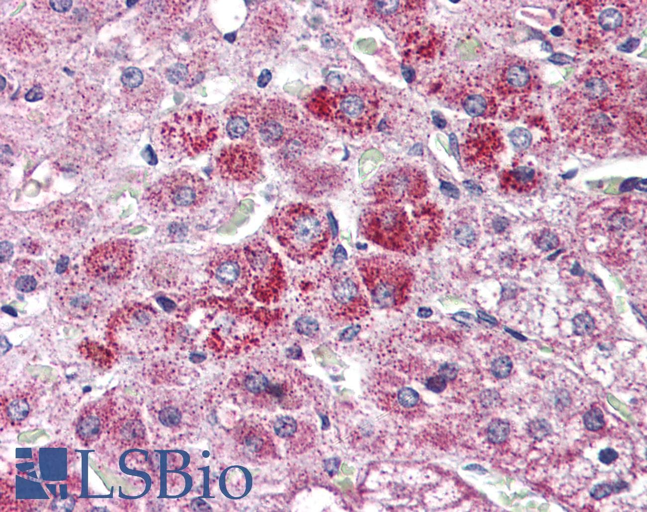 IHC-plus™ Polyclonal Rabbit anti-Human WNT14 / WNT9A Antibody (Internal, IHC)