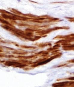 Smoothelin Antibody (clone R4A, Concentrated)
