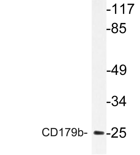 IGLL1 / CD179b Antibody (Val26)