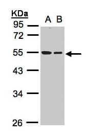 PathPlus™ TUBB / Beta Tubulin Antibody (aa174-428)