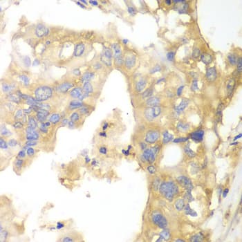Polyclonal Rabbit anti-Human GPBB / PYGB Antibody (IHC, IF, WB)