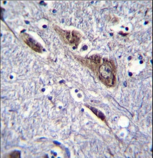 Polyclonal Rabbit anti-Human ELAVL2 / HUB Antibody (aa156-184, IHC, WB)