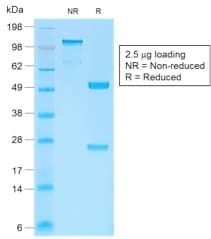 Recombinant Monoclonal Rabbit anti-Human CTNNB1 / Beta Catenin Antibody (clone CTNNB1/2030R, Azide-free,Carrier-free, IHC, IF, WB)