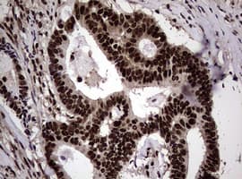 Monoclonal Mouse anti-Human NBN / Nibrin Antibody (clone OTI8E7, IHC, WB)