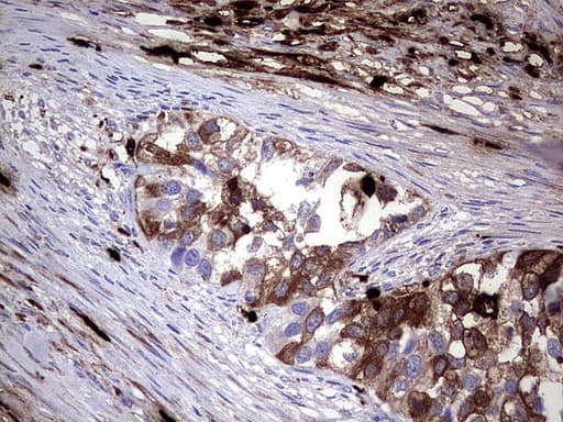 S100A9 / MRP14 Antibody (clone UMAB174, Carrier-free)