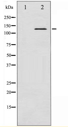 ABL1 / c-ABL Antibody (phospho-Tyr204)