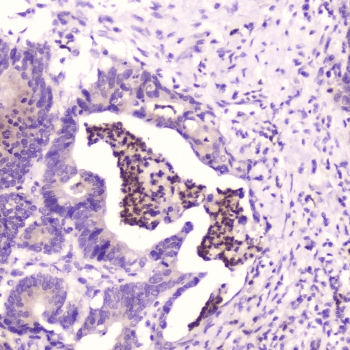 SPARCL1 / Hevin Antibody
