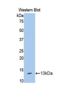 IL13RA1 / IL13R Alpha 1 Antibody (aa137-210, Biotin)