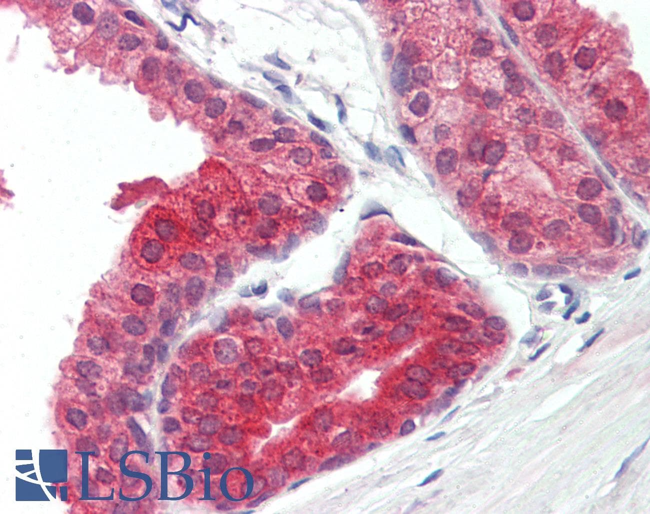 IHC-plus™ PPARG / PPAR Gamma Antibody (aa170-270, clone 3A4A9)