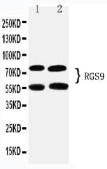 RGS9 Antibody (aa624-638)