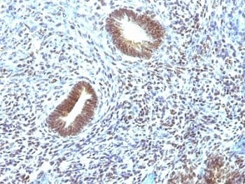 MAP3K1 / MEKK1 Antibody (aa1211-1310, clone 2F6)