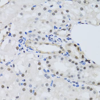 PRPF19 / PRP19 Antibody