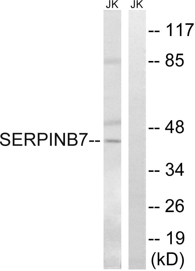 SERPINB7 / MEGSIN Antibody (aa111-160)