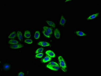 HIATL1 Antibody