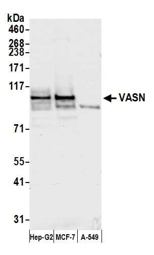 VASN / Vasorin Antibody (aa623-673)