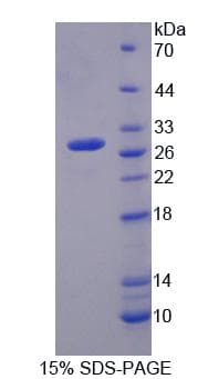 Mouse IVD Protein (Recombinant)