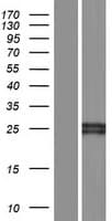 Human FCGR1B Protein (Over-Expression Lysate Myc-DDK (Flag))