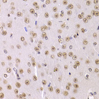PPP1R8 / Rnase E Antibody