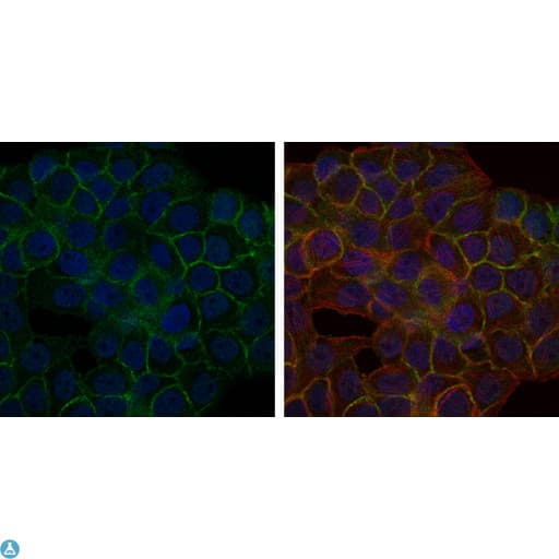 BLNK Antibody